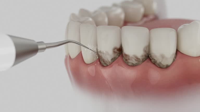 Trusted Teeth Cleaning And Checkup service in Florida Gulf Coast University, FL - Dentist Open Now